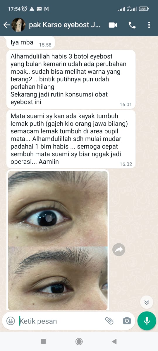 testi-katarak-1.jpg